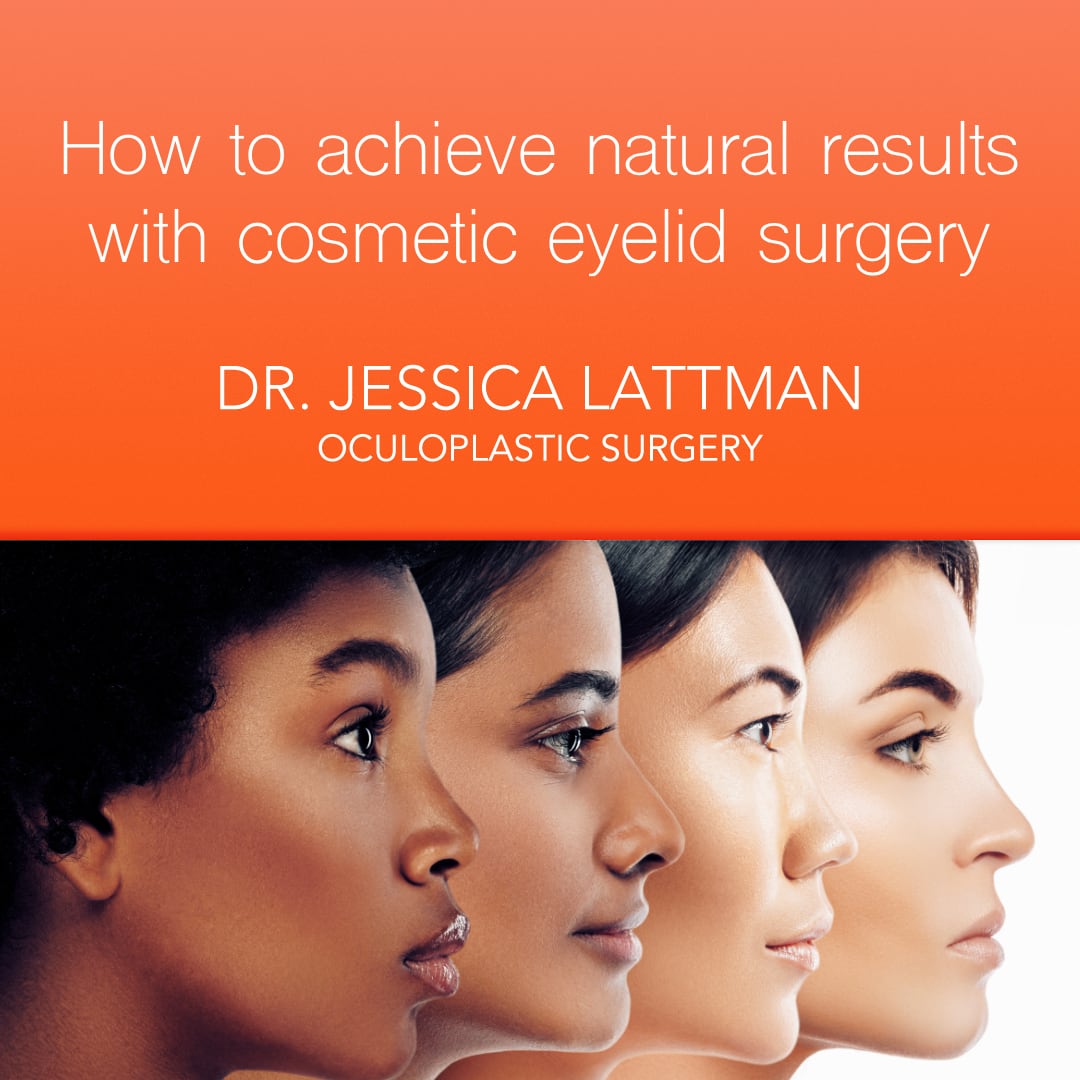 Cosmetic Eyelid Surgery Natural Results