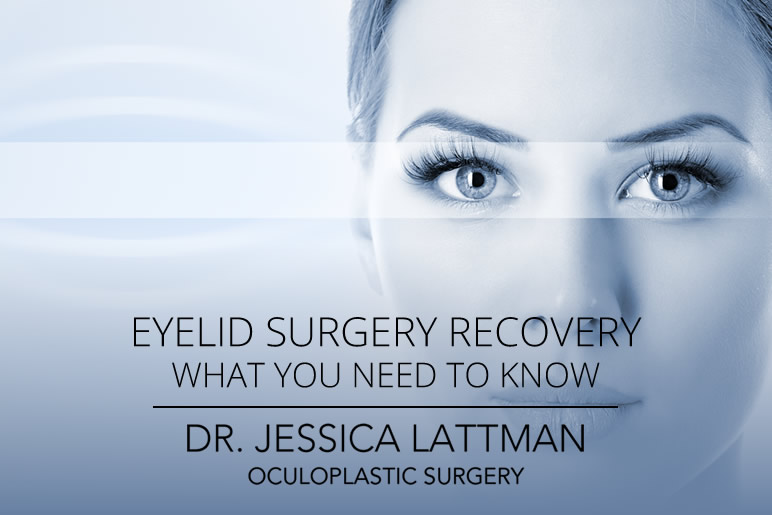 Eyelid Surgery Recovery - What you need to know